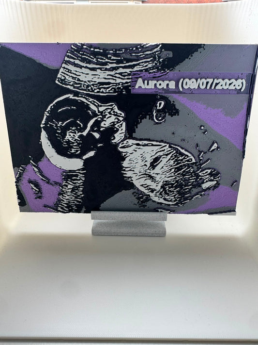 Custom Ultrasound 3D Art – Personalised Framed Keepsake