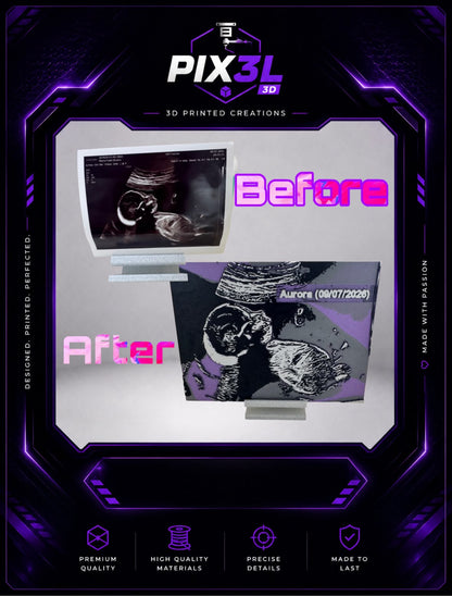 Custom Ultrasound 3D Art – Personalised Framed Keepsake