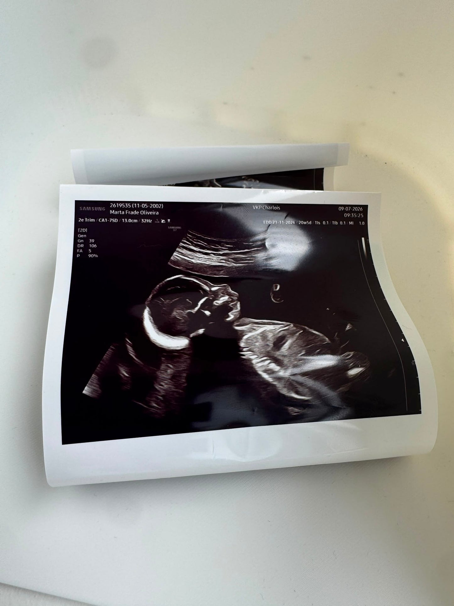 Custom Ultrasound 3D Art – Personalised Framed Keepsake